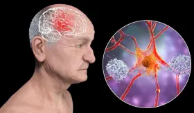 Estas son las enfermedades cardiovasculares que  se relacionan con el deterioro cognitivo y la demencia 