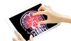 Golpes la cabeza de futbolistas elevan el riesgo de enfermedades neurodegenerativas como párkinson o deme