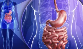 Alimentos ultraprocesados: Un riesgo oculto para la remisión en pacientes con enfermedad de Crohn