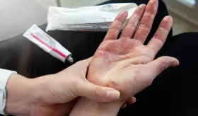 Enfermedad autoinmune: comprensión de los síntomas, riesgos y opciones de tratamiento