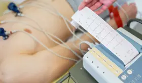 Luego de padecer un ataque cardíaco, el deseo de dormir aumenta, esto trae grandes beneficios para el corazón