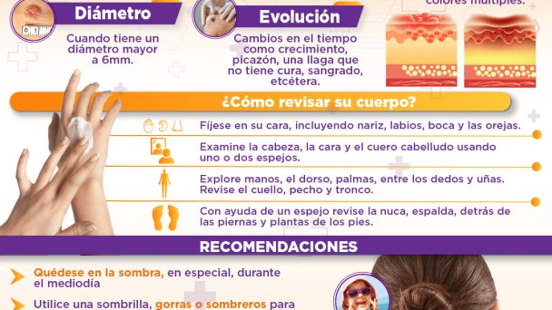 CÁNCER DE PIEL CÁNCER DE PIEL
