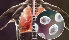 ¿Qué es la Pneumocystis? ¿Qué población se ve más afectada?