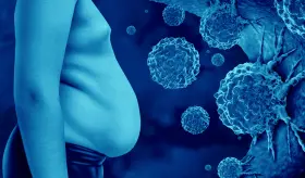 El sobrepeso y la Obesidad aumentan el riesgo de recaída en supervivientes de cáncer