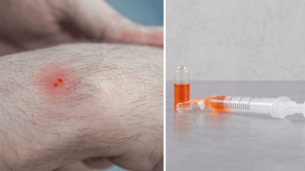 Alerta por suero falsificado para tratar veneno por mordeduras de serpientes