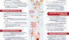 Tipos de mieloma múltiple | Infografía