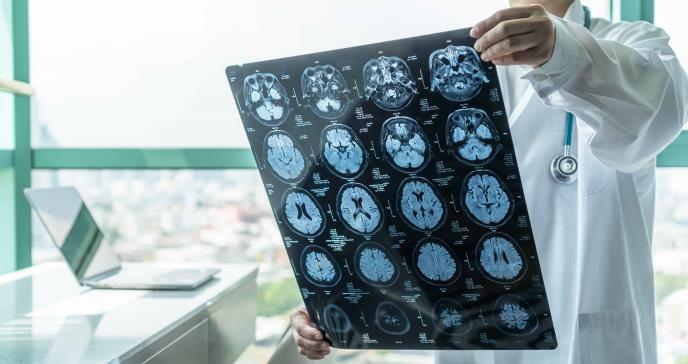 Científicos descubren la edad exacta en que comienza el cerebro a envejecer