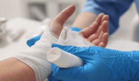 Lesiones por quemaduras aumentan en las festividades de diciembre: riesgos, prevención y tratamientos