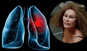 Fallece Jocelyn Wildenstein, conocida como ´Catwoman´ por una embolia pulmonar