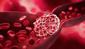 Estas son las recomendaciones a seguir  si toma anticoagulantes: Cómo prevenir riesgos y complicaciones