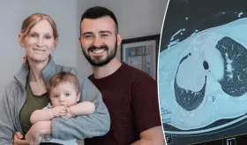 Doctores salvan la vida de un bebé y su madre tras encontrar un tumor pulmonar del tamaño de una toronja