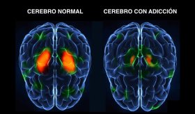 Estudio demuestra que el cerebro de los jóvenes puede indicar el riesgo de adicción antes de que ocurra