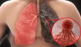 Estudio revela cuántos minutos de vida pierdes con cada cigarrillo que fumas