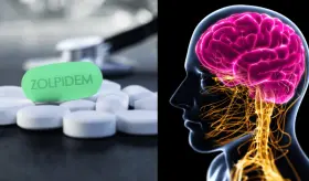 El somn&iacute;fero m&aacute;s recetado para tratar el insomnio podr&iacute;a aumentar el riesgo de alzh&eacute;imer