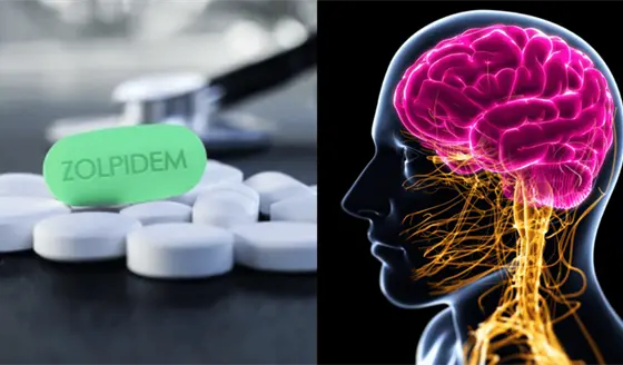 El somn&iacute;fero m&aacute;s recetado para tratar el insomnio podr&iacute;a aumentar el riesgo de alzh&eacute;imer