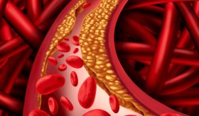 Cardiólogo advierte sobre el riesgo de cáncer e ictus por consumo de galletas y alimentos ultraprocesados