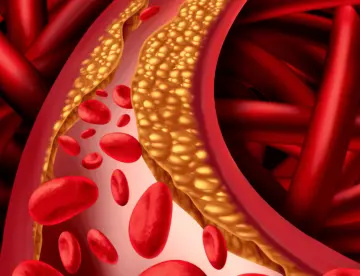 Cardiólogo advierte sobre el riesgo de cáncer e ictus por consumo de galletas y alimentos ultraprocesados