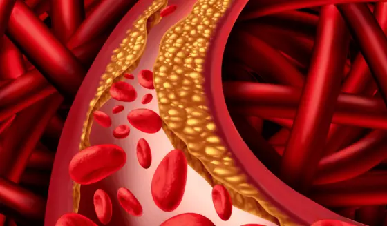 Cardiólogo advierte sobre el riesgo de cáncer e ictus por consumo de galletas y alimentos ultraprocesados