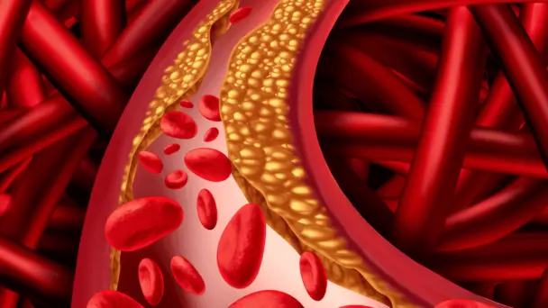 Cardiólogo advierte sobre el riesgo de cáncer e ictus por consumo de galletas y alimentos ultraprocesados