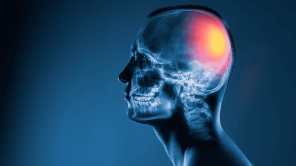 ¿Por qué los hombres tienen una mayor probabilidad de morir por lesiones cerebrales traumáticas? ¿Por qué los hombres tienen una mayor probabilidad de morir por lesiones cerebrales traumáticas?