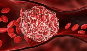 Exposición a luz roja reduce el riesgo de coágulos sanguíneos y ataques cardíacos, según estudio