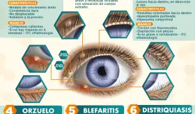 Trastornos de los p&aacute;rpados