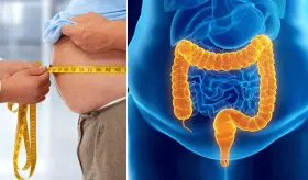 ¿Por qué los científicos rechazan el IMC para diagnosticar obesidad? Nuevas formas de diagnóstico