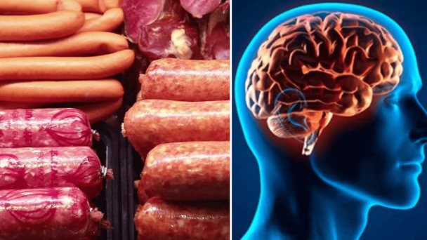 Consumo de carne roja procesada aumenta el riesgo de demencia al favorecer la inflamación y daño celular Consumo de carne roja procesada aumenta el riesgo de demencia al favorecer la inflamación y daño celular