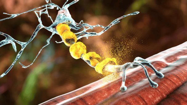 FDA advierte el riesgo de anafilaxia con acetato de glatiramer en tratamiento de esclerosis múltiple FDA advierte el riesgo de anafilaxia con acetato de glatiramer en tratamiento de esclerosis múltiple