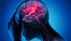 El divorcio parental y su vínculo con el aumento de hormonas del estrés: Factor de riesgo para el ictus