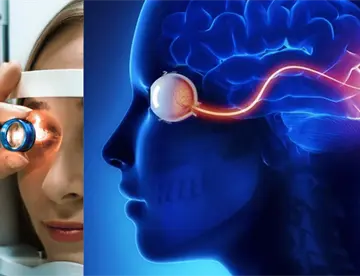 Estudio revela que un simple escaneo de retina podría predecir el riesgo de accidente cerebrovascular