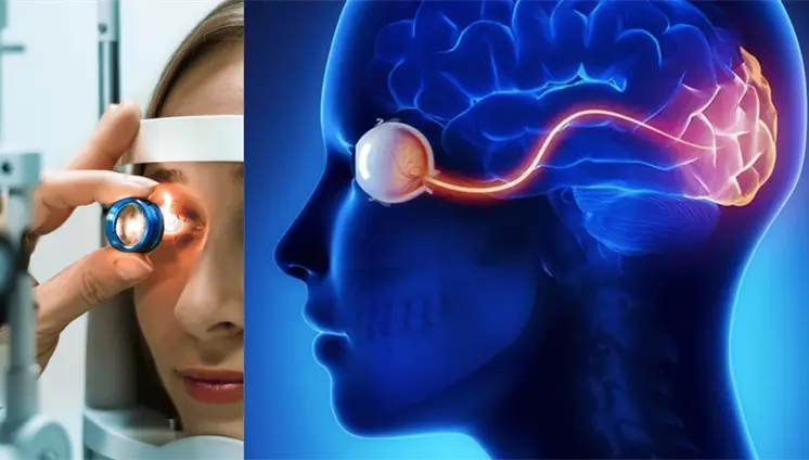 Estudio revela que un simple escaneo de retina podría predecir el riesgo de accidente cerebrovascular Estudio revela que un simple escaneo de retina podría predecir el riesgo de accidente cerebrovascular