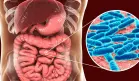 SIBO: Causas, síntomas y tratamientos para el sobrecrecimiento bacteriano del intestino delgado