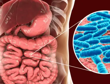 SIBO: Causas, síntomas y tratamientos para el sobrecrecimiento bacteriano del intestino delgado