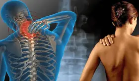 Estudio revela que la desinhibición espinal podría ser la causa de los dolores en la fibromialgia