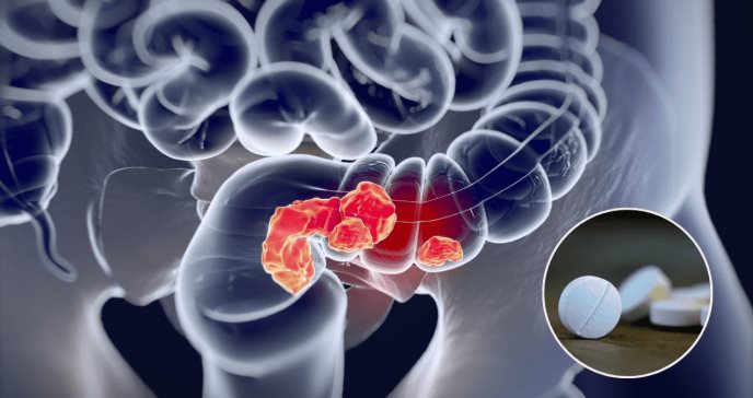 Estudio revela que la aspirina en dosis bajas reduce la incidencia del cáncer colorrectal