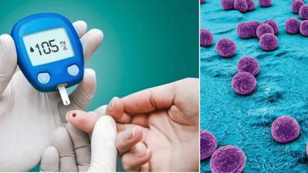 La presencia de staphylococcus aureus en diabéticos aumenta la resistencia y mutaciones bacterianas La presencia de staphylococcus aureus en diabéticos aumenta la resistencia y mutaciones bacterianas