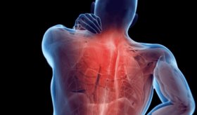 ¿Por qué los nudos musculares causan tanto dolor? Te contamos cómo aliviarlo