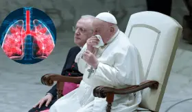 ¿Qué es la bronquitis persistente que llevó al Papa Francisco al hospital? Síntomas, causas y tratamiento