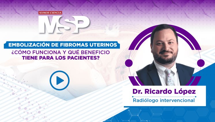 Embolización de fibromas uterinos: ¿Cómo funciona y qué beneficio tiene para los pacientes? Embolización de fibromas uterinos: ¿Cómo funciona y qué beneficio tiene para los pacientes?