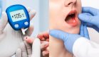 Recomendación clave: Visita dental anual y nuevos enfoques para la enfermedad hepática en diabetes