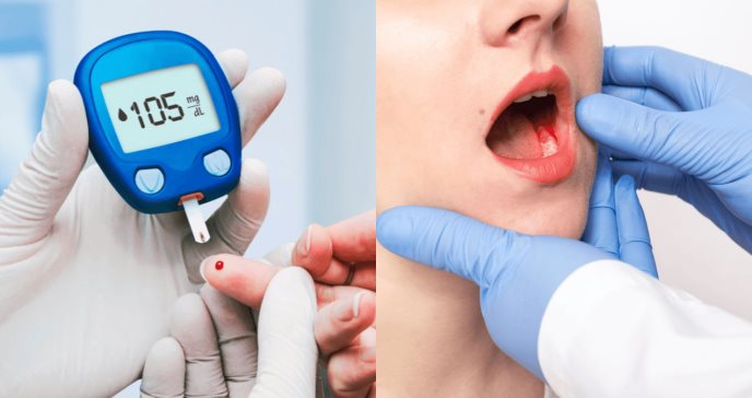 Recomendación clave: Visita dental anual y nuevos enfoques para la enfermedad hepática en diabetes