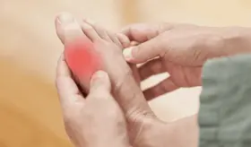 Mujeres con gota reciben menos orientación sobre el autocontrol de la enfermedad, según un estudio