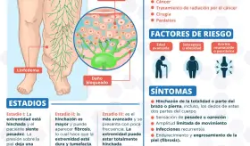 LINFEDEMA