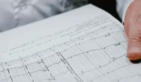 Estas son las enfermedades que pueden detectarse mediante un electrocardiograma