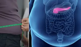 1 de cada 6 jóvenes tendrá obesidad para 2050, predice un análisis global