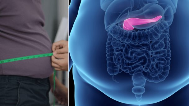 1 de cada 6 jóvenes tendrá obesidad para 2050, predice un análisis global 1 de cada 6 jóvenes tendrá obesidad para 2050, predice un análisis global