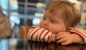 Edición genética mediante CRISPR-Cas9 elimina el cromosoma 21 adicional en células con síndrome de Down