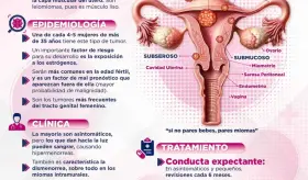 MIOMAS UTERINOS