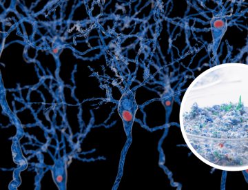 Detectan microplásticos en el cerebro con niveles hasta cinco veces mayores en personas con demencia